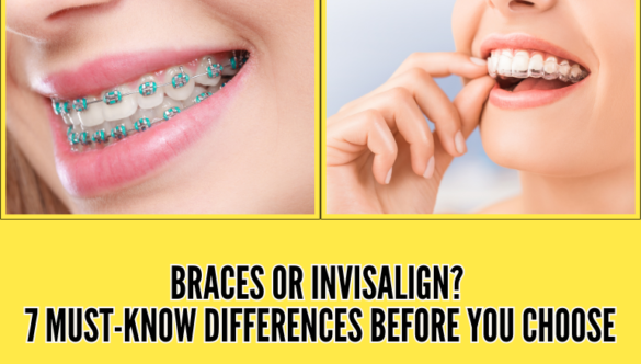 Braces or Invisalign? 7 Must-Know Differences Before You Choose