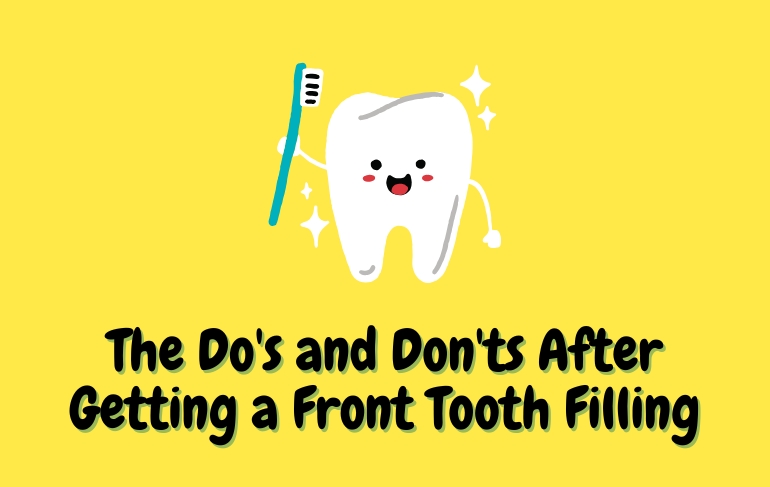 The Do’s and Don’ts After Getting a Front Tooth Filling