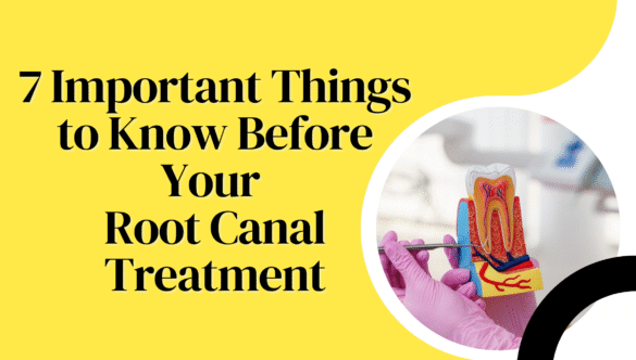 7 Important Things to Know Before Your Root Canal Treatment